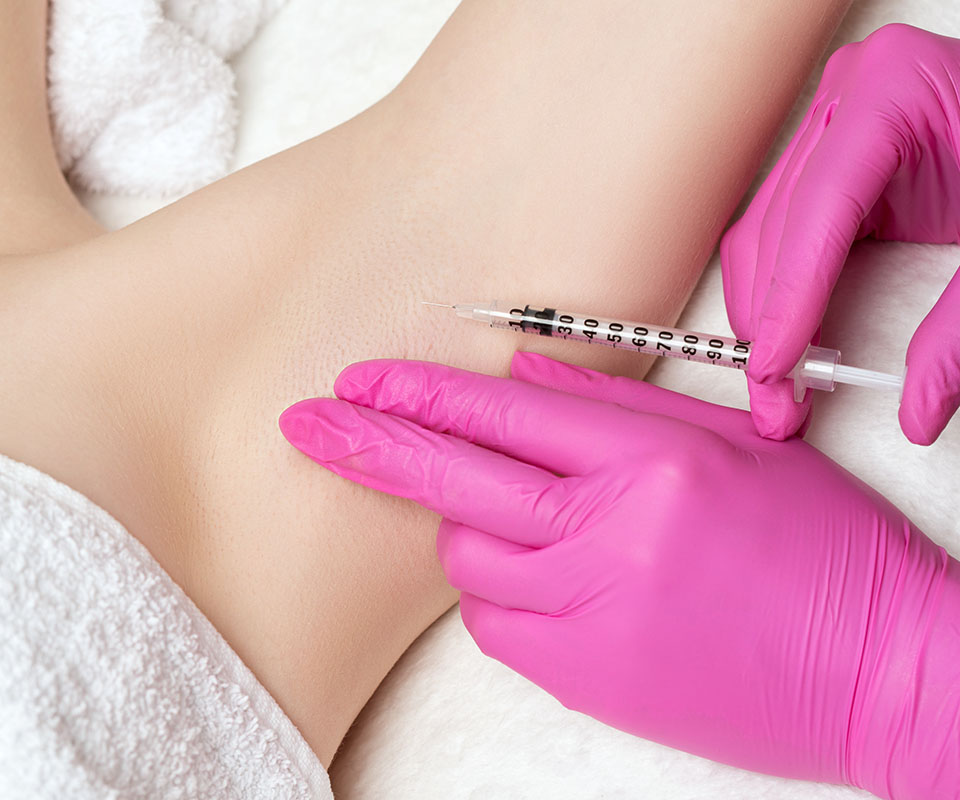 Botox for Sweating