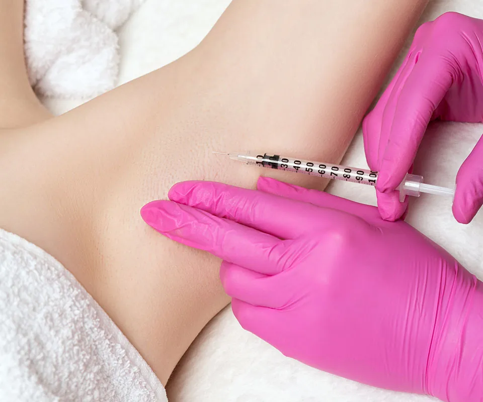 Botox for Sweating