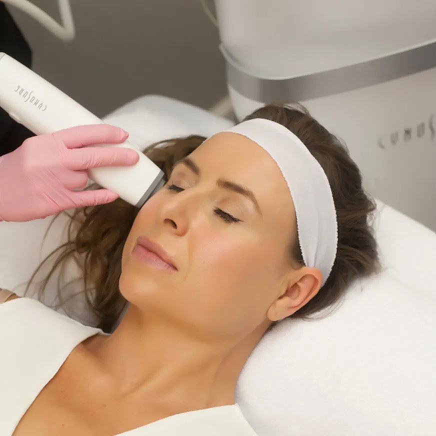 RF Microneedling